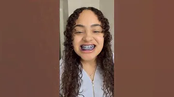 Does The Hismile Teeth Whitening Paste Really Work?